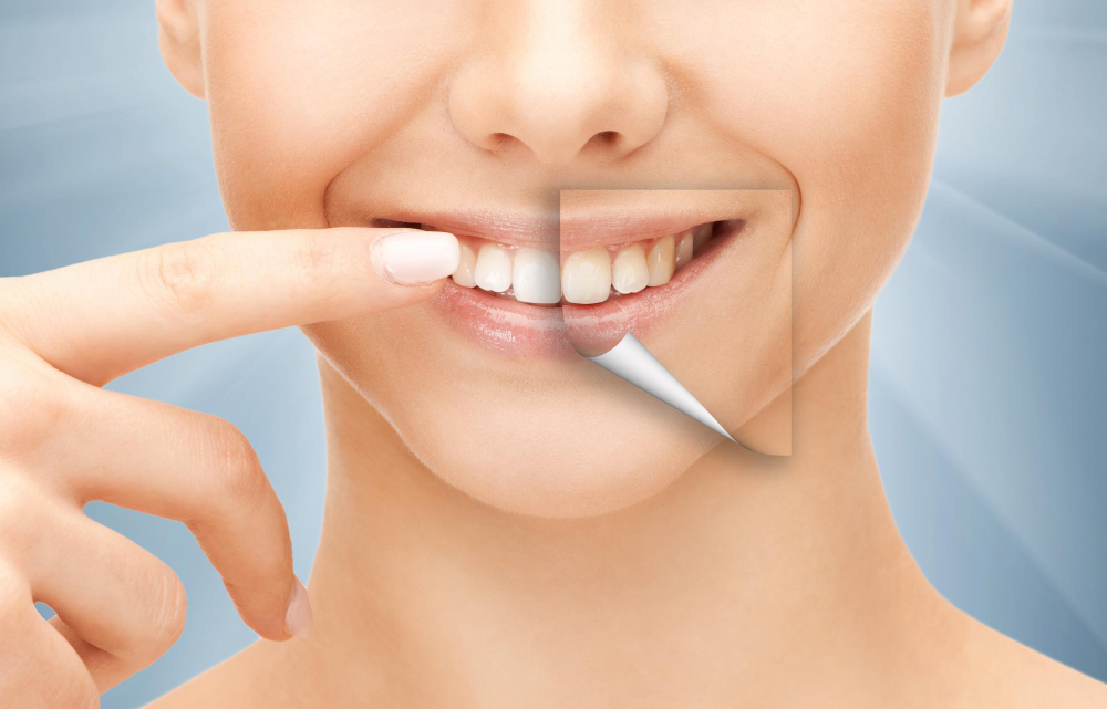dental-health-concept-beautiful-woman-pointing-her-teeth
